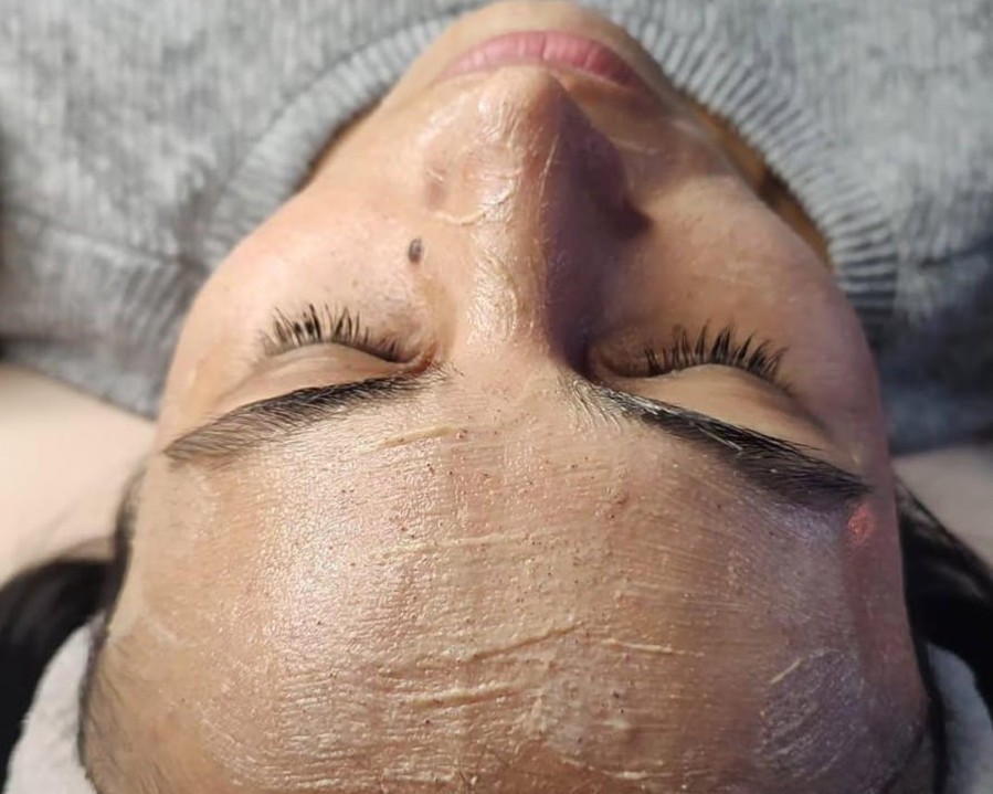 Limpieza Facial Profunda